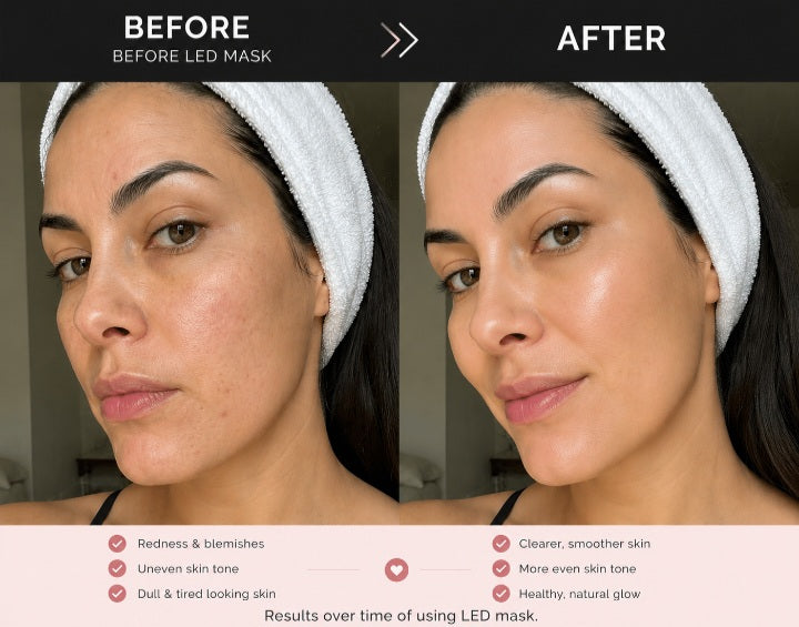 7 Color Led Mask Light Therapy- Facial Treatment